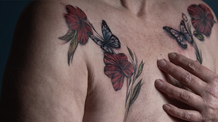 Tatuaje gratuito en los Países Bajos para sobrevivientes del cáncer de seno  - RNN Red Nacional De Noticias